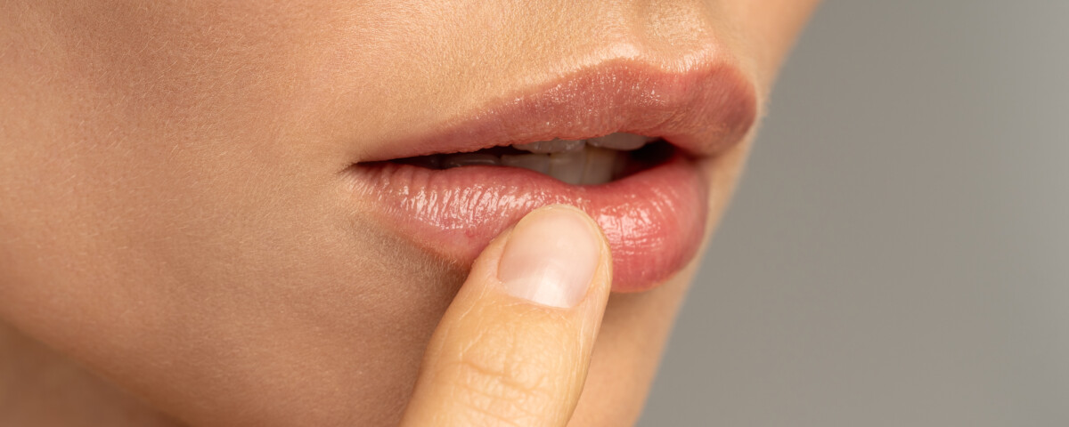 Close up of woman applying moisturizing nourishing balm to her lips with her finger to prevent dryness and chapping in the cold season. Lip protection.