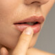 Close up of woman applying moisturizing nourishing balm to her lips with her finger to prevent dryness and chapping in the cold season. Lip protection.